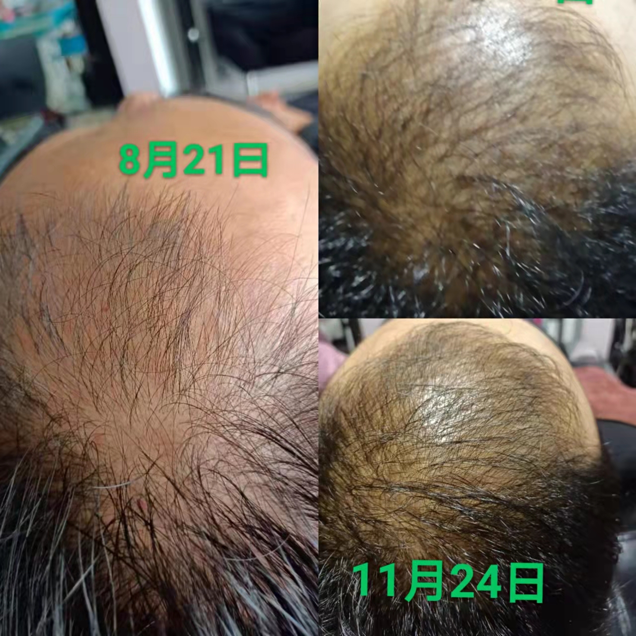 秀丝顿植物养发防脱育发，采用天然植物成分，针对头发问题进行根源性解决。